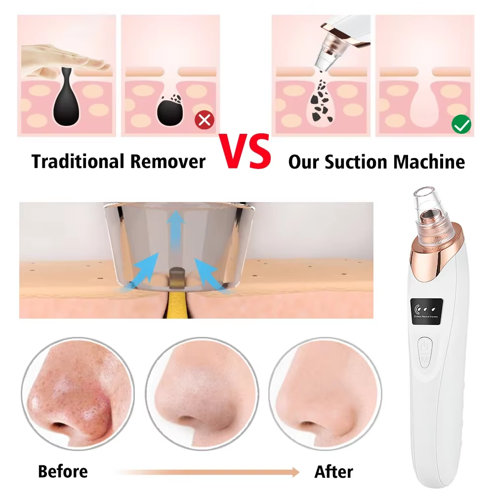 Blackhead Remover Vacuum Pore Adsorber Face Cleaner Electric Pimple Acne Black Head Removal Rechargeable Face Cleaning Tool